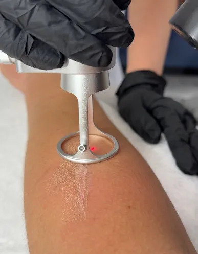 шліфування шрамів