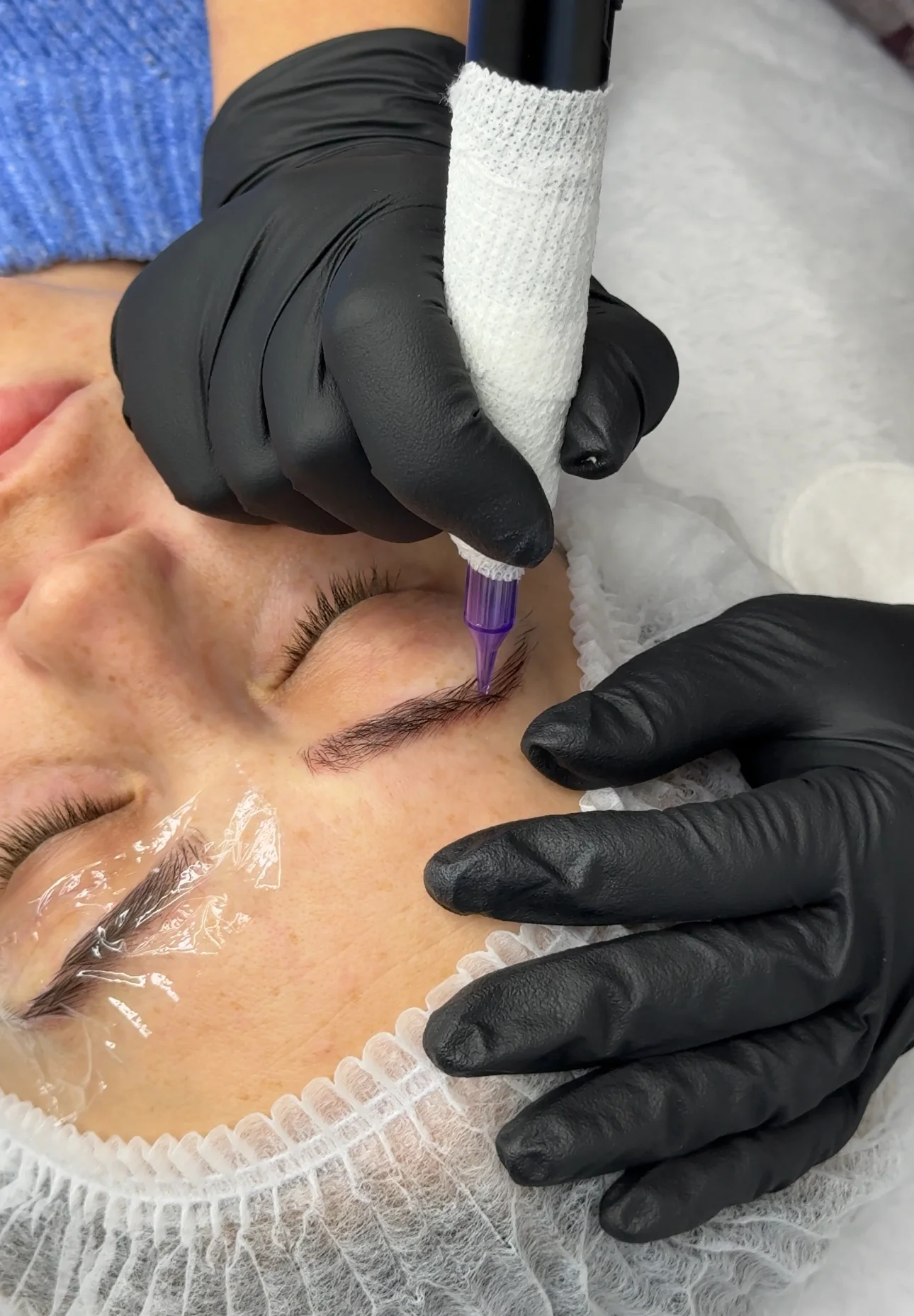 Видалення татуажу ремувером